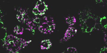 New Insights into How Obesity Impacts Mitochondrial Function: Latest Research