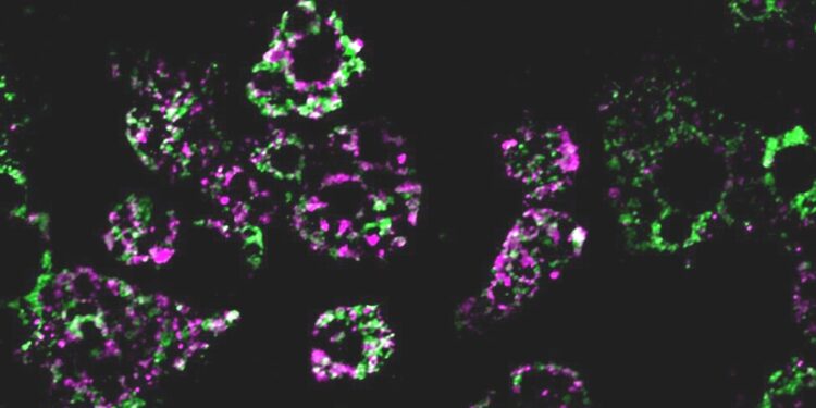 New Insights into How Obesity Impacts Mitochondrial Function: Latest Research