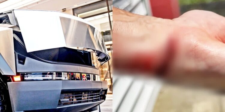 The Essential Role of a Tesla Cybertruck in Your Kitchen Amidst Increasing Incidents of Injuries