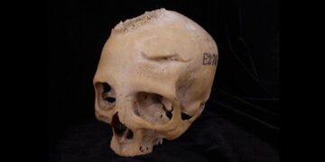 Remarkable Discovery: Surgical Attempts on Cancer by Ancient Egyptians Unveiled | Science & Health Insights
