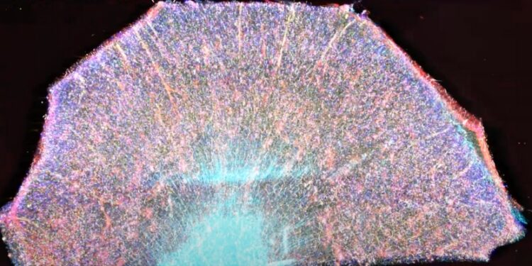 Revolutionary Imaging Method Captures Alzheimer’s Disease Progression with Unrivaled Detail: ScienceAlert