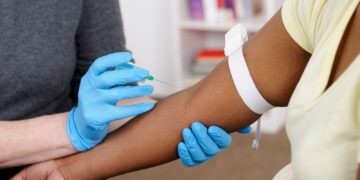 Revolutionary Blood Test Offers Early Breast Cancer Relapse Detection