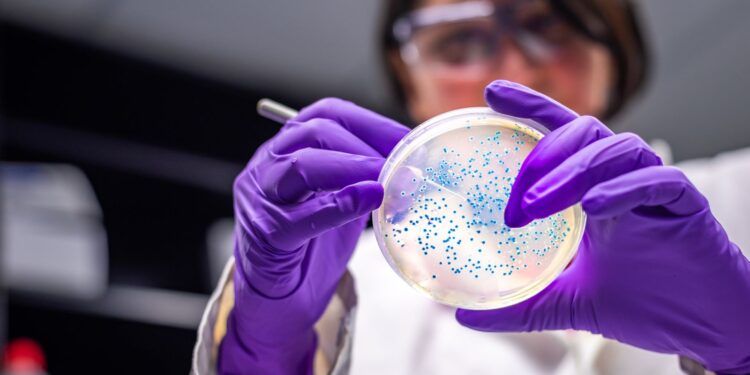 Recognizing E.coli Infection Symptoms: Latest UK Outbreak Insights
