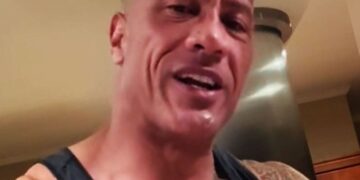 Update on The Rock’s Recovery from Elbow Injury