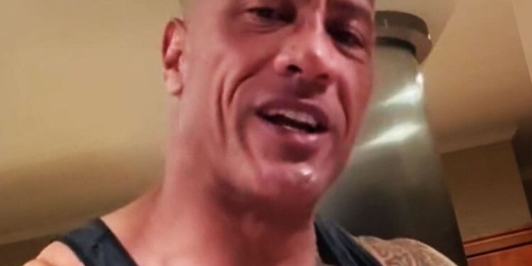 Update on The Rock’s Recovery from Elbow Injury